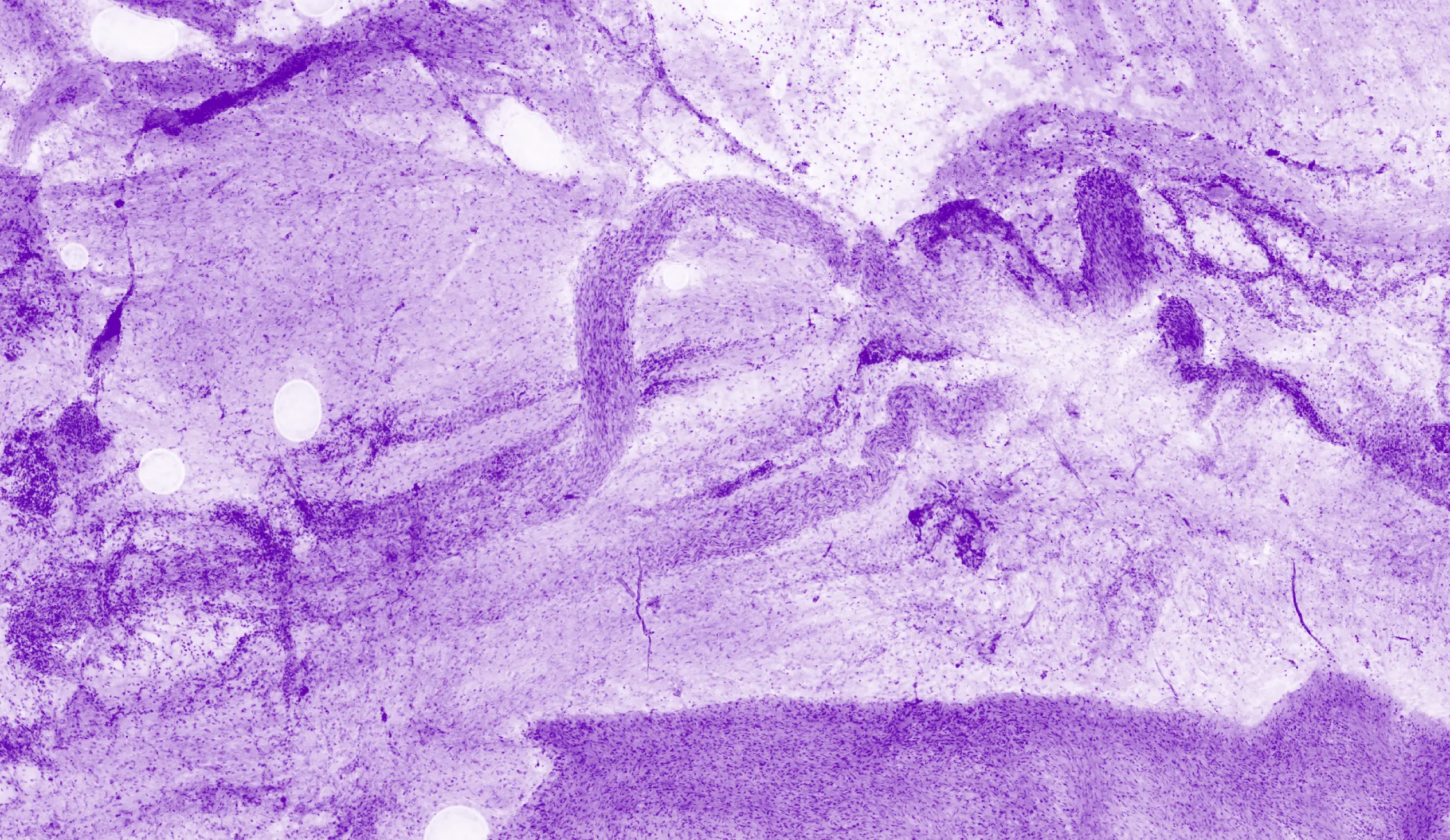 Histolog tissue