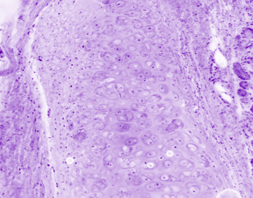 Bronchus cartilage