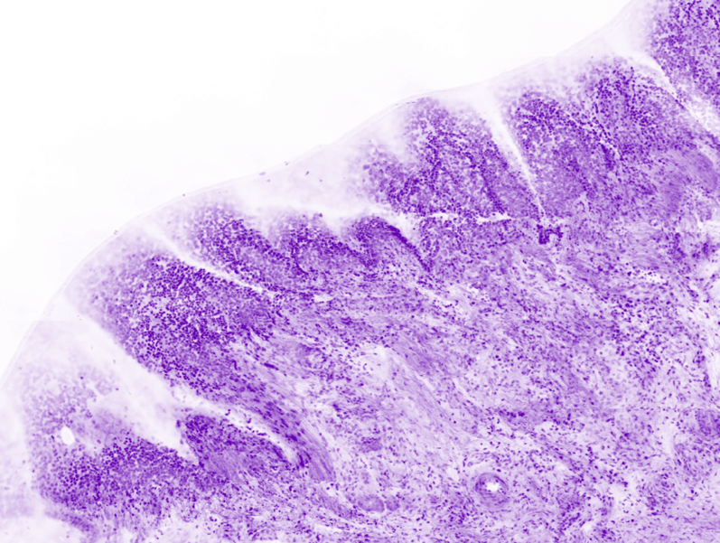 Bronchus columnar epithelium