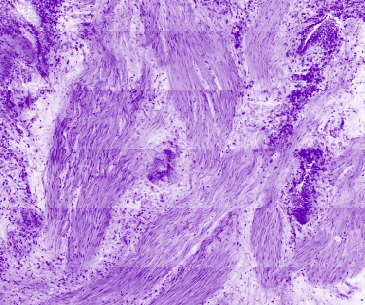 Bronchus smooth muscle