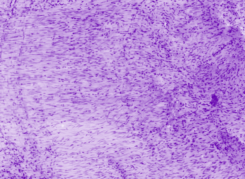 Colon muscularis
