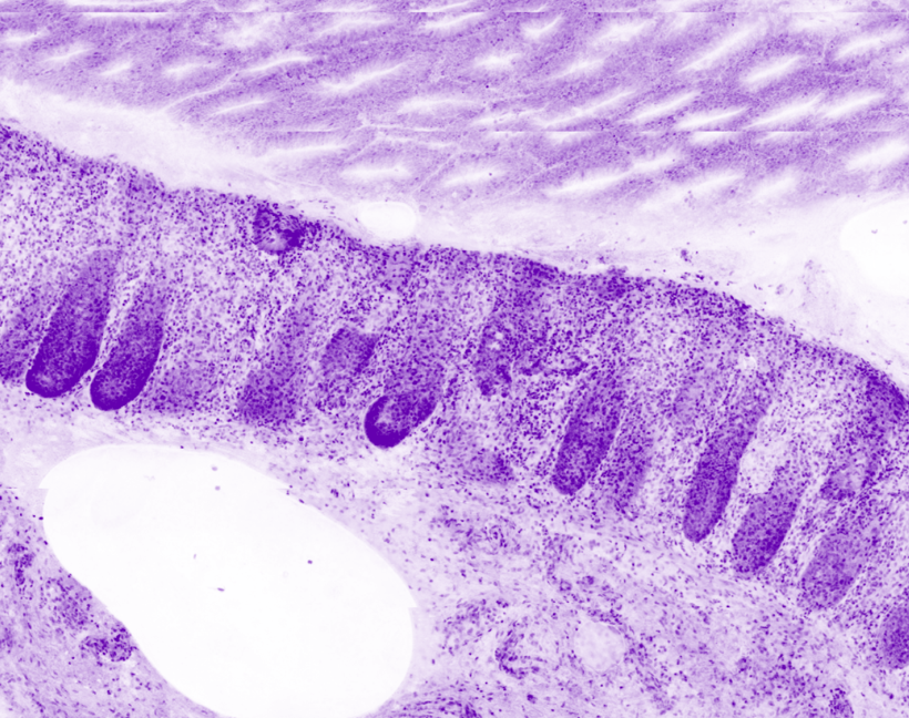 Section of colon mucosa