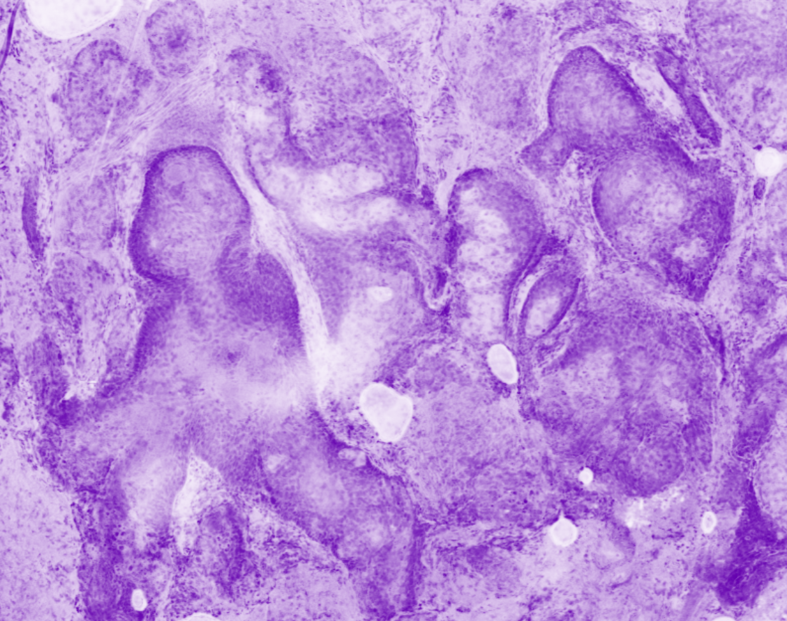 Skin specimen - Sebaceous glands