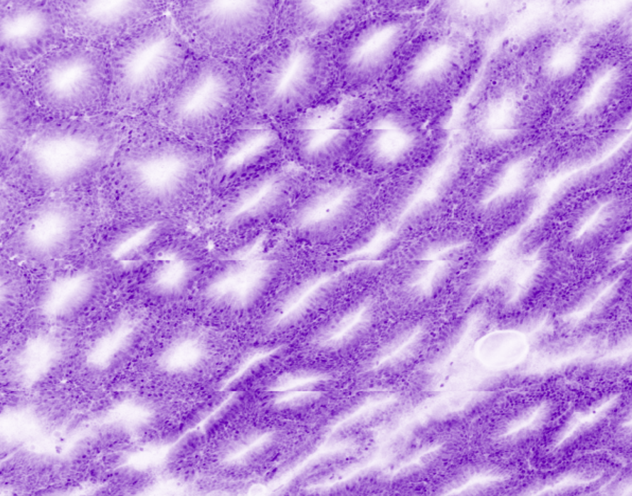 Surface of colon mucosa