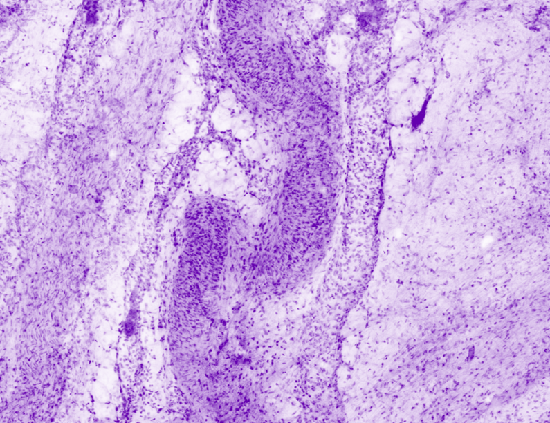 Prostatic vein and artery on capsula