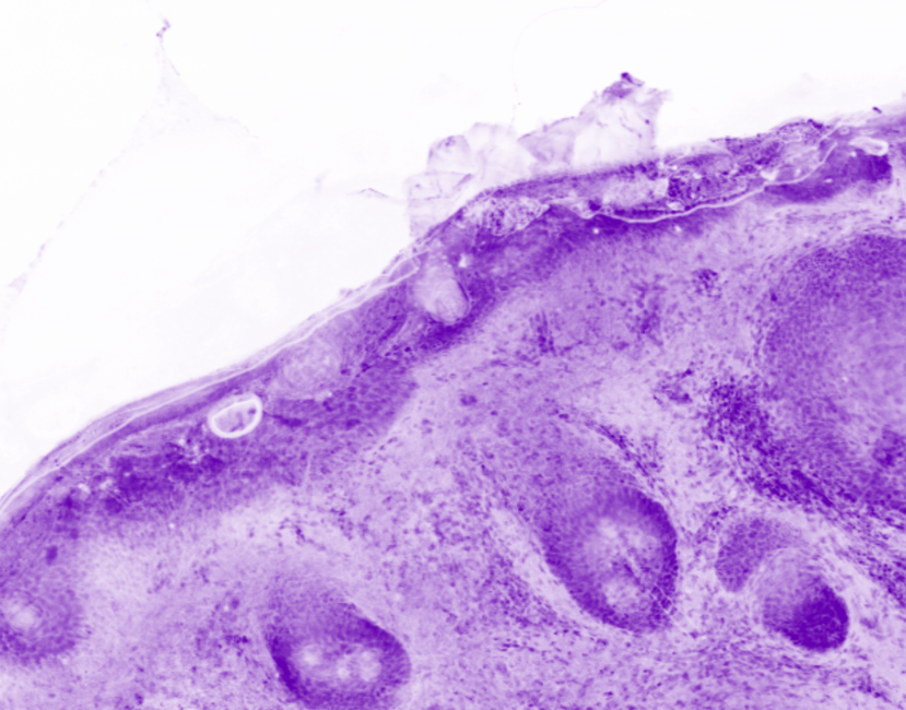 Skin specimen - Epidermis
